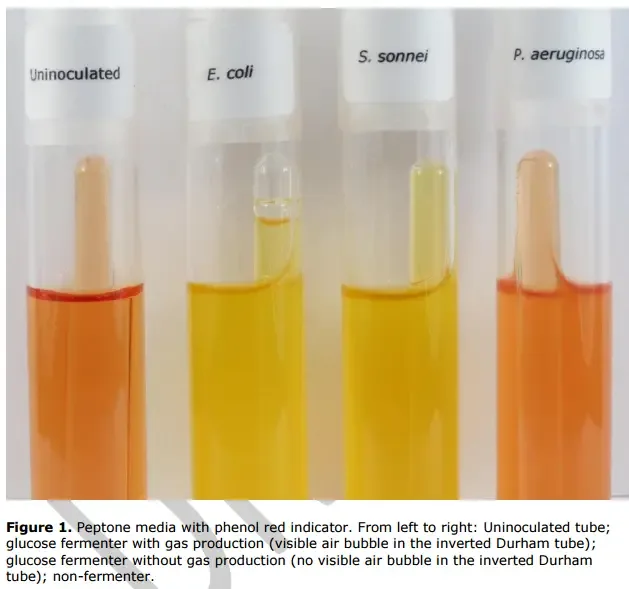 Result and Interpretation of Carbohydrate fermentation test