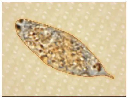 Egg of Schistosoma haematobium