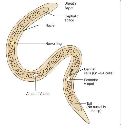 Morphology of Wuchereria bancrofti