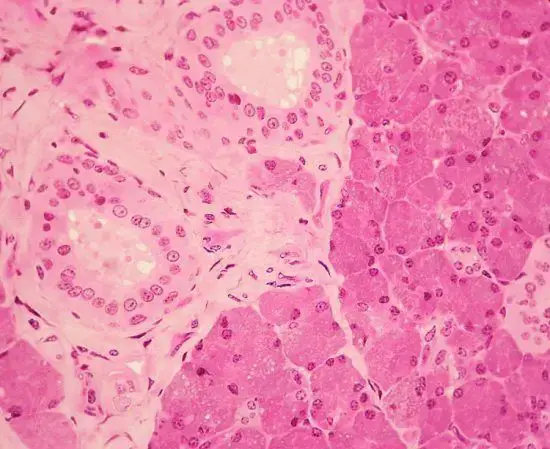 Parotid Glands