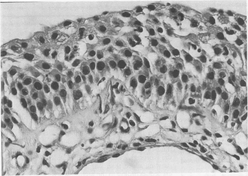 stratified cuboidal epithelium black and white