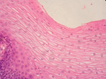 Stratified Squamous Epithelium Microscope, Microscope at 400X
