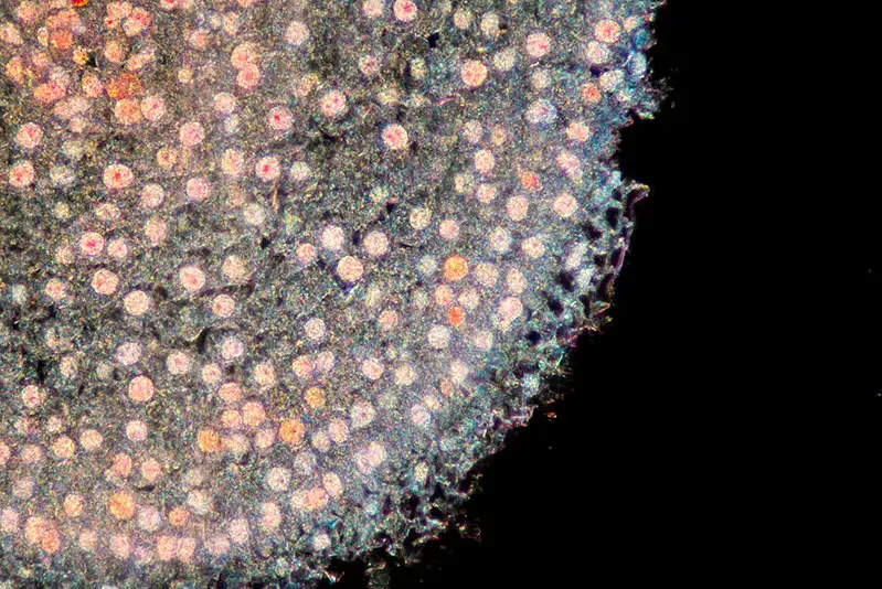 Darkfield Microscope Images – Mitosis Allium Root Tip Feulgen, Darkfield Microscopy