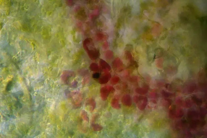 Darkfield Microscope Images – Callery Pear, darkfield