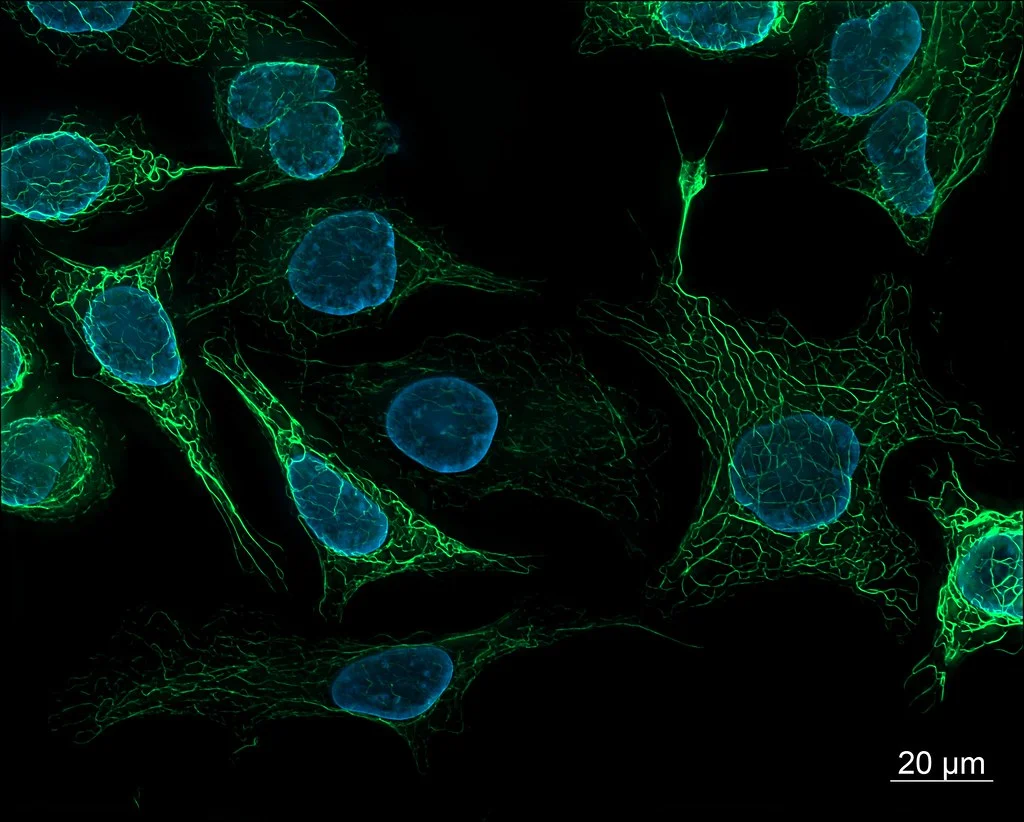 SK8/18-2 human derived cells, fluorescence microscopy | Source: www.flickr.com