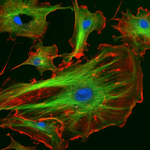 Endothelial cells observed under fluorescence microscopy | Source: www.researchgate.net