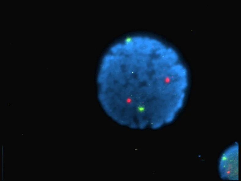 Fluorescence Microscopy Images – Human lymphocyte nucleus stained with DAPI with chromosome 13 (green) and 21 (red) centromere probes hybridized (Fluorescent in situ hybridization (FISH))