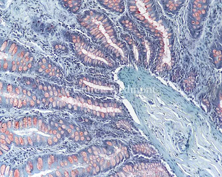 bright field microscope image