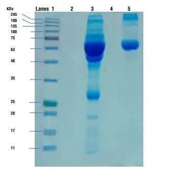 SDS-PAGE - Sodium Dodecyl Sulfate Polyacrylamide Gel Electrophoresis (PAGE) 8 Observation and Result of SDS-PAGE