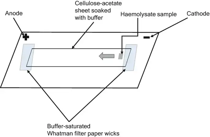 Principle of Cellulose Acetate Electrophoresis