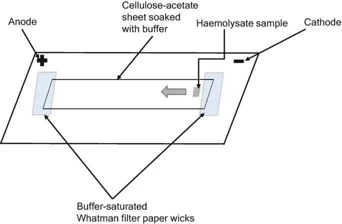 Principle of Cellulose Acetate Electrophoresis