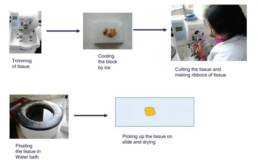 Here, various stages of section cutting are highlighted. Initial tissue trimming is performed. The block is then chilled in ice. The block is positioned in the microtome, and the clearance angle is set to 5 °C. The tissue is cut carefully, and the tissue ribbon is set on the water bath using a brush. The tissue is then lifted up by placing a glass slide perpendicularly in front of it, and when the slide touches the tissue, it is retracted vertically.