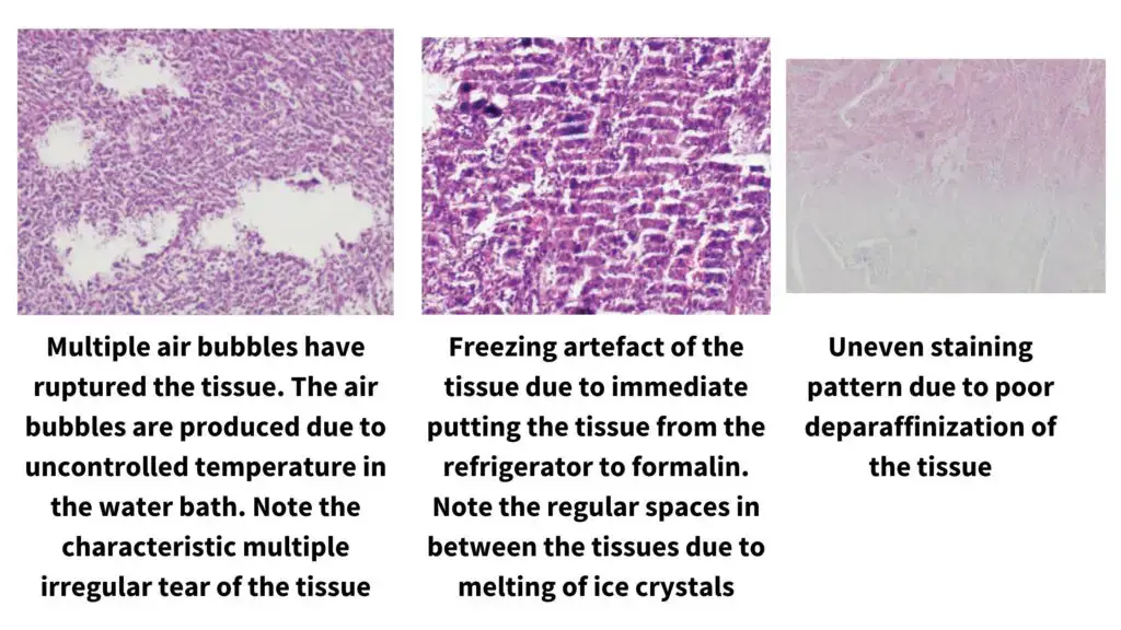 Steps of Tissue Sectioning