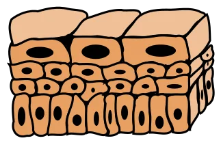 Transitional epithelium tissue. 