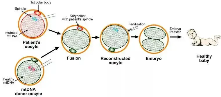 Mitochondrial replacement therapy