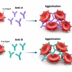 Scientific diagram showing anti-A antibodies binding to A₁ red blood cells and anti-B antibodies binding to B red blood cells, producing agglutination.