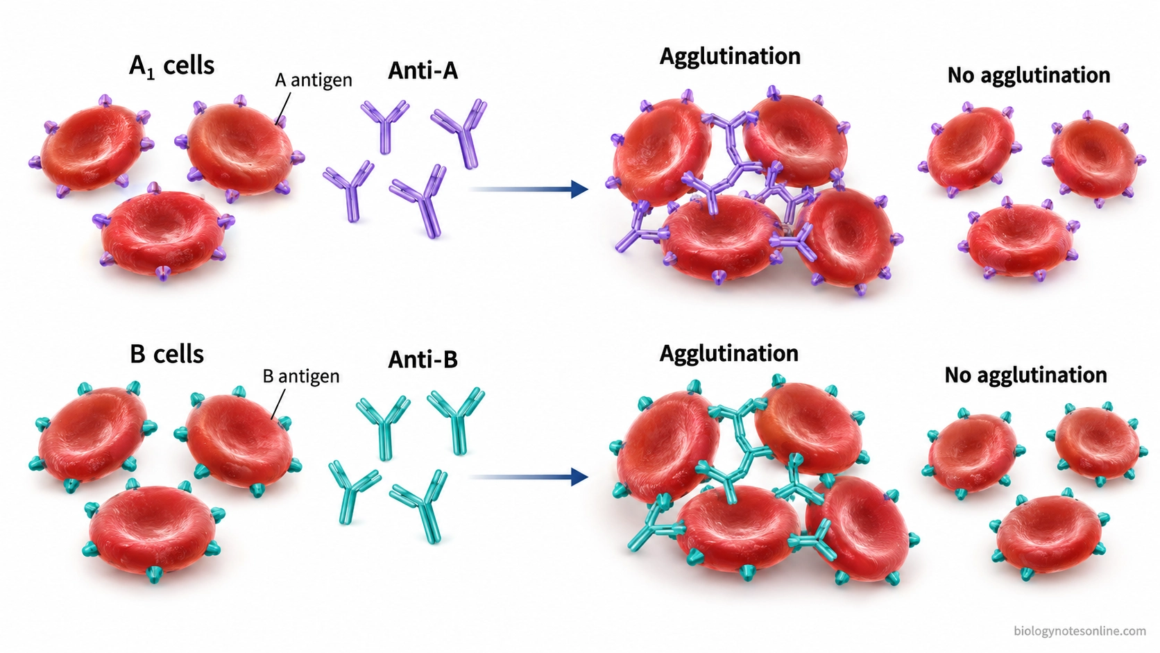 Scientific diagram showing anti-A antibodies binding to A₁ red blood cells and anti-B antibodies binding to B red blood cells, producing agglutination.