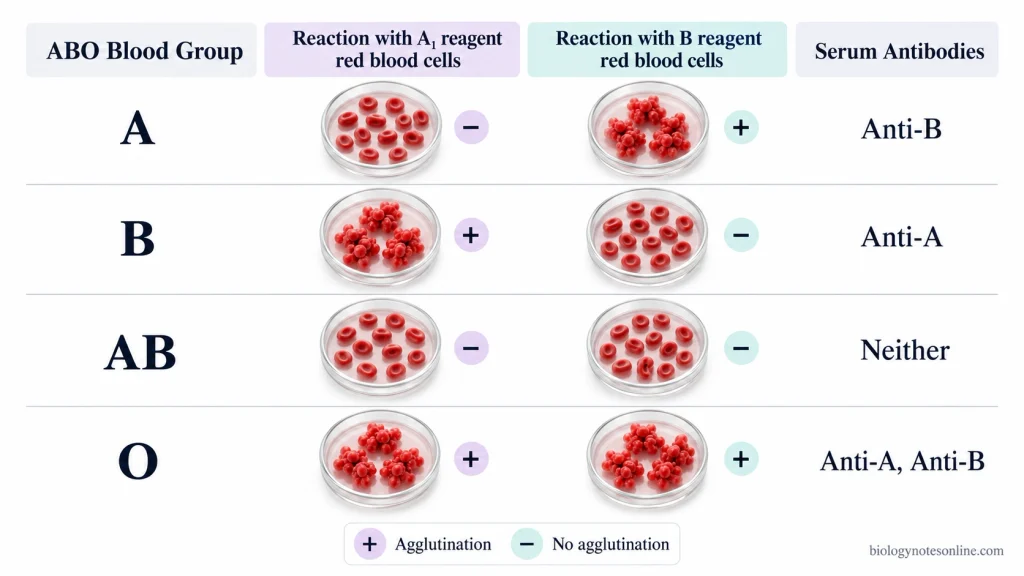 Reverse blood grouping chart showing A₁ and B reagent cell agglutination patterns for blood groups A, B, AB and O, with their expected serum antibodies.