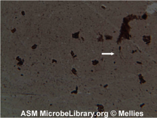 Leifson Technique for Bacterial Flagella Staining 2 Bacterial Flagella Staining by Leifson Flagella Stain