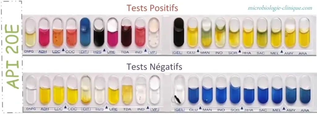API (Analytical Profile Index) 20E Test Result, Principle, Procedure 3 API 20E positive vs negative