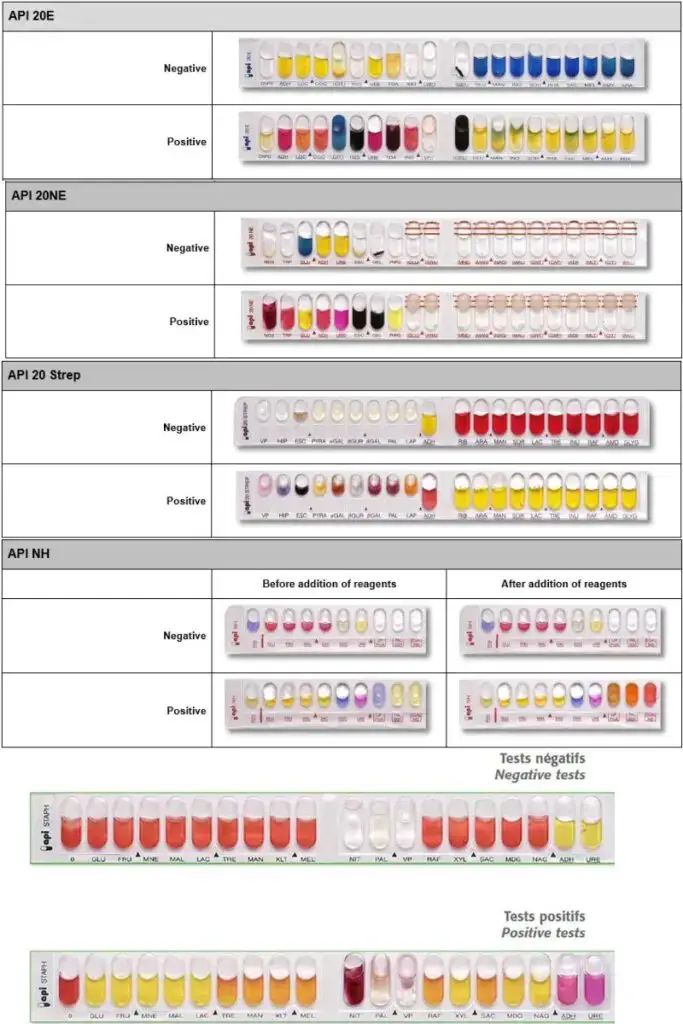 API (Analytical Profile Index) 20E Test Result, Principle, Procedure ...