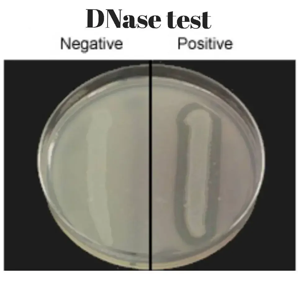 DNase test negative and positive after adding HCL
