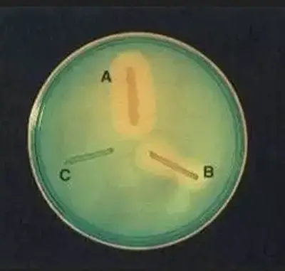 DNase Test Agar w/ Methyl Green: quadrant A and B test positive while quadrant C tests negative.