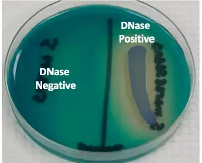 The left side of the plate tests negative while the right side tests positive to DNase test.
Picture Source: quizlet.com