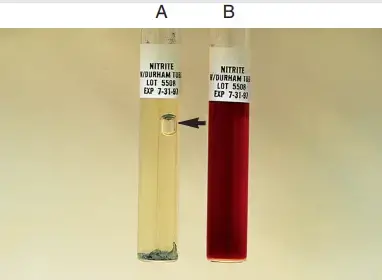 Result of Nitrite Reduction Test – A, Positive, no color change after addition of zinc dust and gas in Durham tube (arrow). B, Negative.
