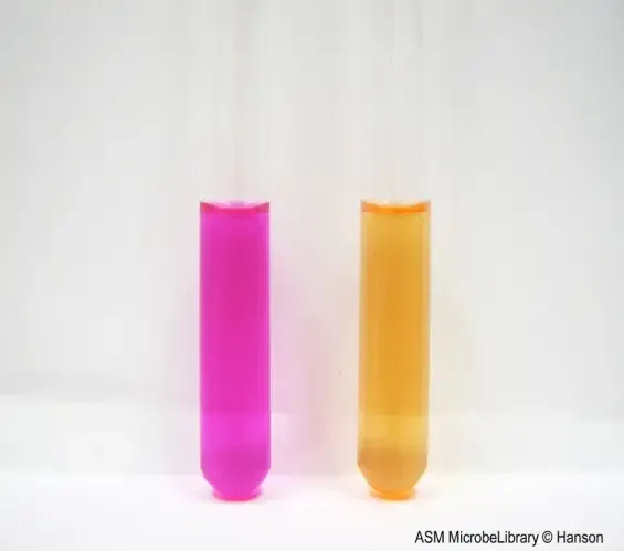 Urease Test - Principle, Procedure, Result 2 Urea broth test results. Urea broth test tubes were inoculated as follows: (a) Proteus vulgaris (urease positive) and (b) Escherichia coli (urease negative). All samples were incubated at 37o C for 16 hours