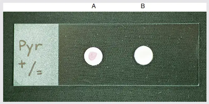 Interpretation of Results – A, Positive. B, Negative
