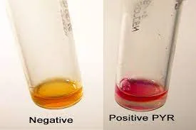 Interpretation of Results
