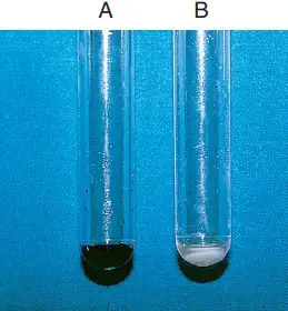 Interpretations and results of Hippurate Hydrolysis Test – . A, Positive. B, Negative
