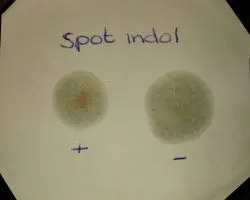 Spot Indole Test