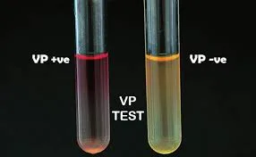 Results and Interpretation of Voges Proskauer (VP) Test
