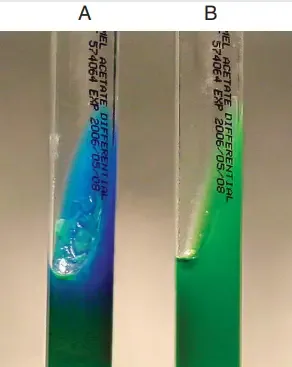 Acetate utilization. A, Positive. B, Negative
