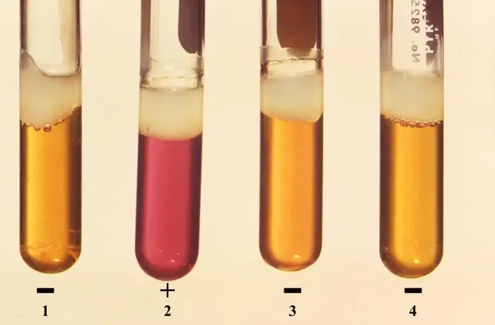 Ornithine decarboxylase test results