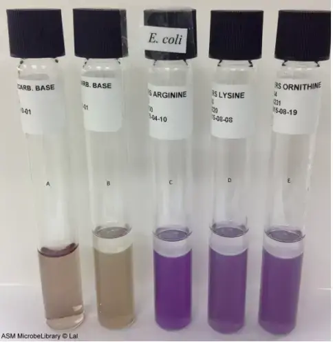 Moeller’s Decarboxylase media. A: Uninoculated base, B: Base inoculated with E. coli, C: Arginine broth inoculated with E. coli, D: Lysine broth inoculated with E. coli, E: Ornithine broth inoculated with E. coli. Purple color in tubes C, D, and E indicate that this strain of E. coli is arginine, lysine, and ornithine decarboxylase positive.
