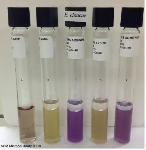 Moeller’s Decarboxylase media. A: Uninoculated base, B: Base inoculated withEnterobacter cloacae, C: Arginine broth inoculated with E. cloacae, D: Lysine broth inoculated with E. cloacae, E: Ornithine broth inoculated with E. cloacae. Purple color in tubes C and E indicate that E. cloacae is arginine and ornithine decarboxylase positive