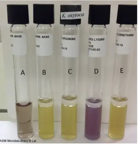 Moeller’s Decarboxylase media. A: Uninoculated base, B: Base inoculated withKlebsiella oxytoca, C: Arginine broth inoculated with K. oxytoca, D: Lysine broth inoculated with K. oxytoca, E: Ornithine broth inoculated with K. oxytoca. Purple color in tube D indicates that K. oxytoca is lysine decarboxylase positive while yellow color in tubes C and E (absence of purple color) indicates that it is arginine and ornithine decarboxylase negative.
