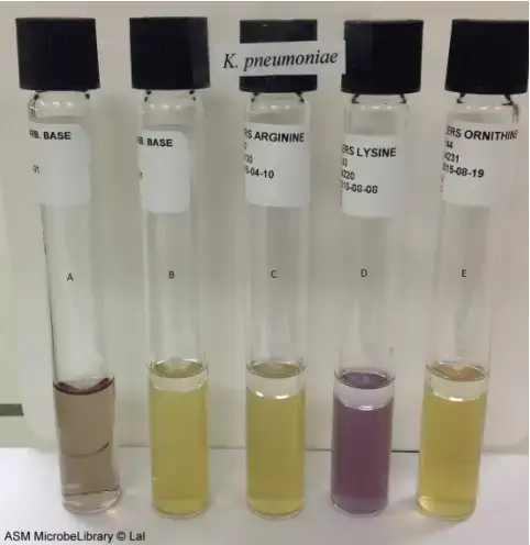 Moeller’s Decarboxylase media. A: Uninoculated base, B: Base inoculated withKlebsiella pneumoniae, C: Arginine broth inoculated with K. pneumoniae, D: Lysine broth inoculated with K. pneumoniae, E: Ornithine broth inoculated with K. pneumoniae. Purple color in tube D indicates that K. pneumoniae is lysine decarboxylase positive while yellow color in tubes C and E (absence of purple color) indicates that it is arginine and ornithine decarboxylase negative.
