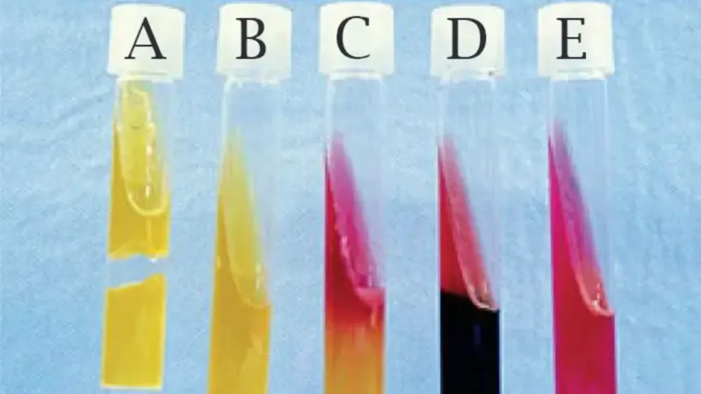Results of Kligler’s Iron Agar Test – A: Acid/Acid, Gas; B: Acid/Acid, No gas; C: Alkaline/Acid; D: Alkaline /Acid, H2S+; E: Alkaline/Alkaline
