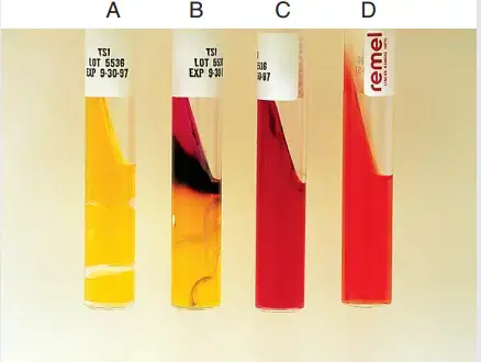 Expected Results of Triple Sugar Iron (TSI) Agar test – A, Acid slant/acid butt with gas, no H2 S (A/A). B, Alkaline slant/acid butt, no gas, H2 S-positive (K/A H2S1). C, Alkaline slant/alkaline butt, no gas, no H2 S (K/K). D, Uninoculated tube.
