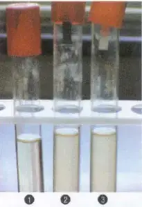 1. Control, 2. Salmonella serotype, 3. Typhimurium
Escherichia coli