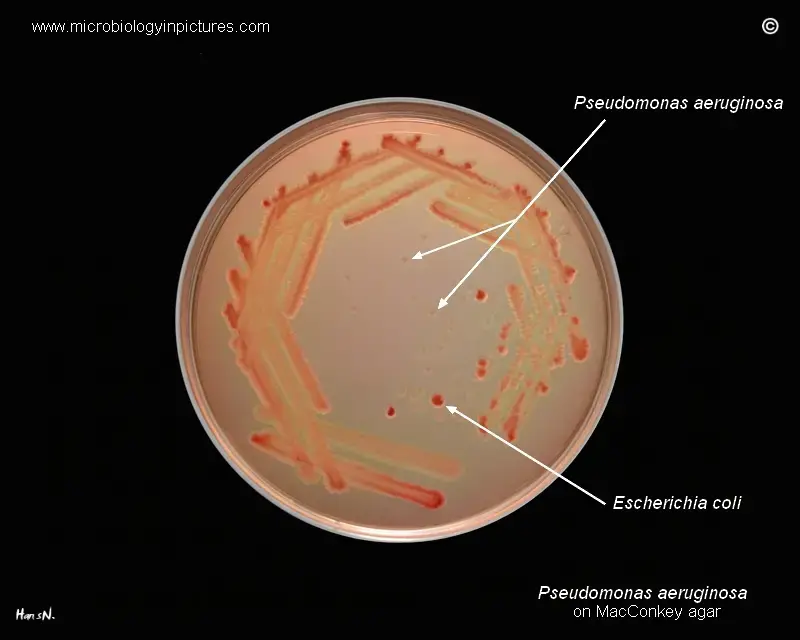 Pseudomonas aeruginosa on MacConkey agar. Lactose-negative colonies of P.aeruginosa and lactose-positive colonies of Escherichia coli. 