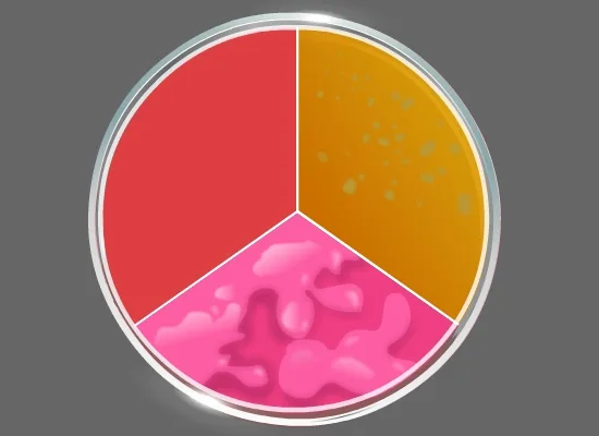 Identification of Bacillus species using Mannitol Egg Yolk Polymixin agar.
