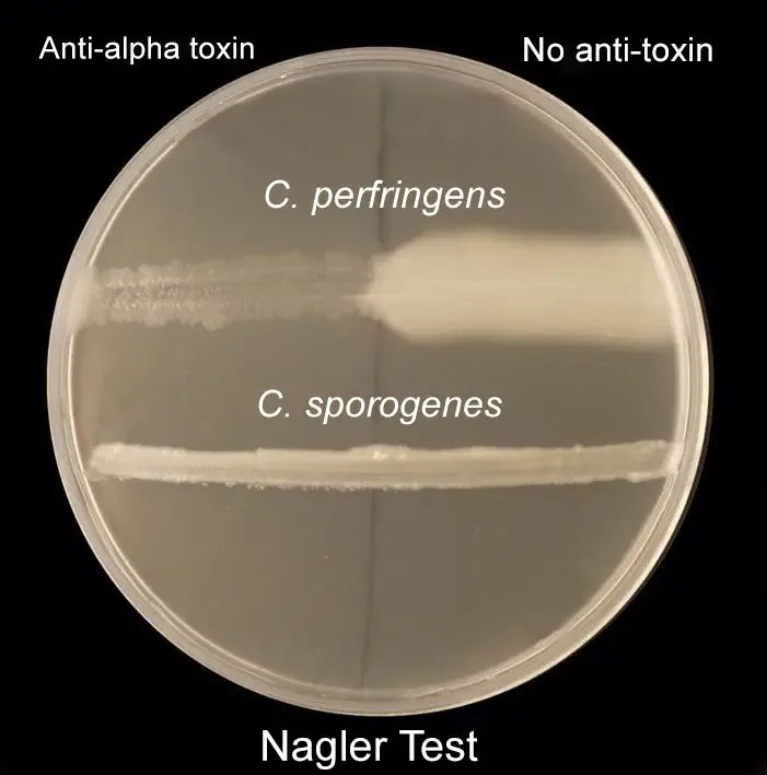 For Bacillus Species identification
