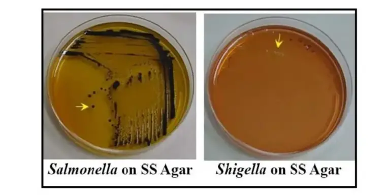 Salmonella Shigella Agar (SS Agar) - Principle, Composition ...