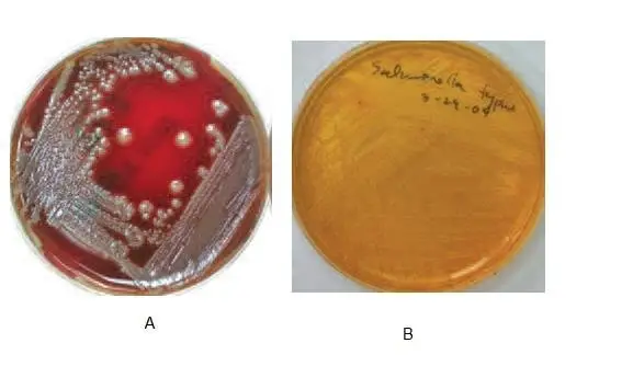 A.) Escherichia Coli on sheep blood agar B.) Salmonella Typhi on salmonella-shigella agar.