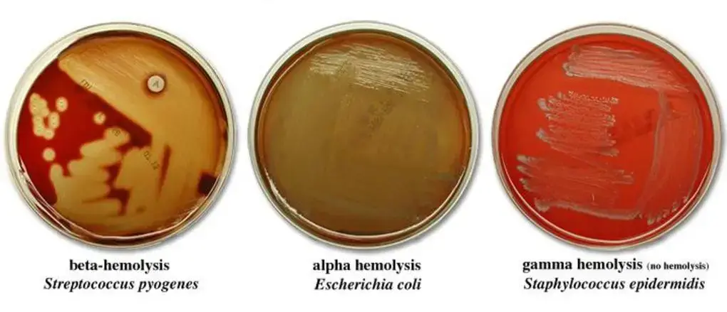 Blood agar plate results – Blood Agar and Hemolysis
